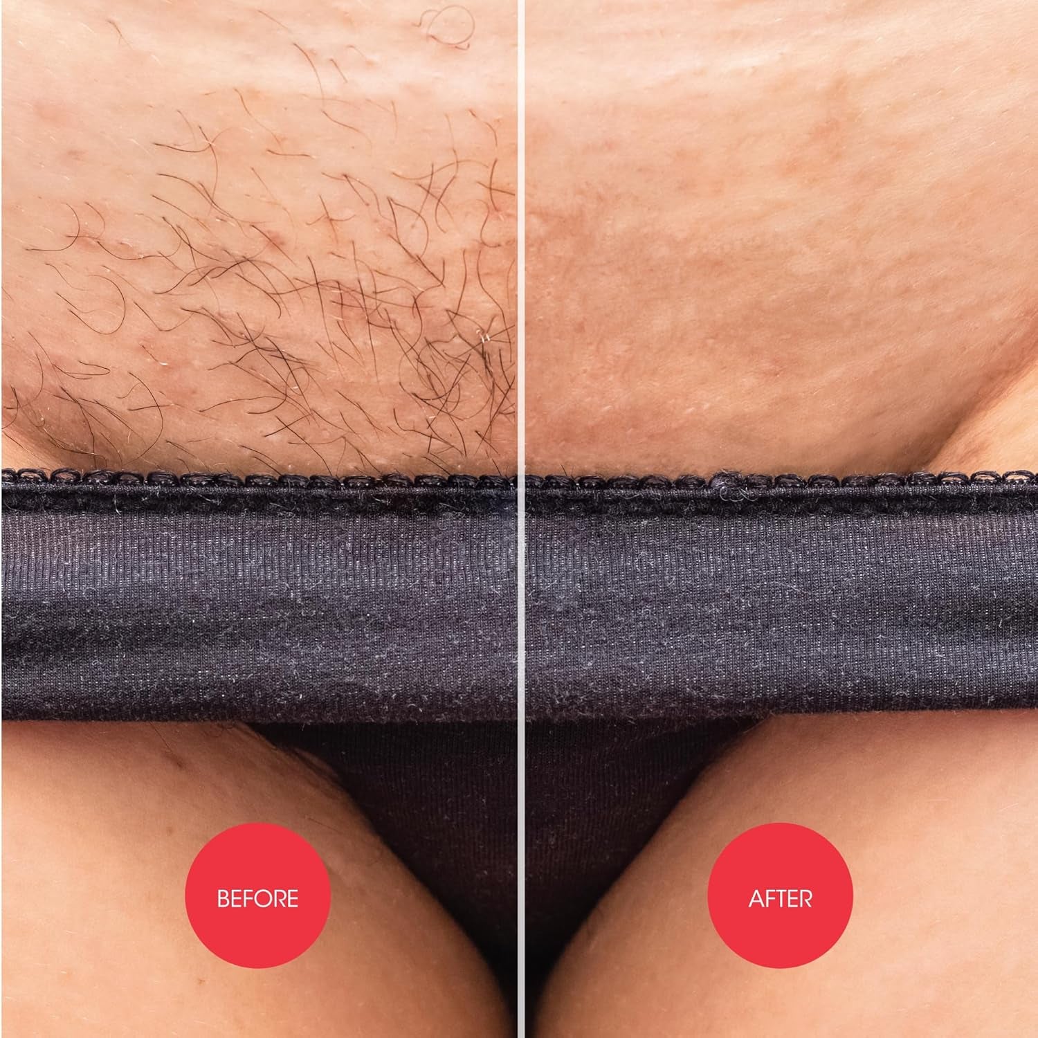 Intimate Hair Removal Cream for Women 150 Ml